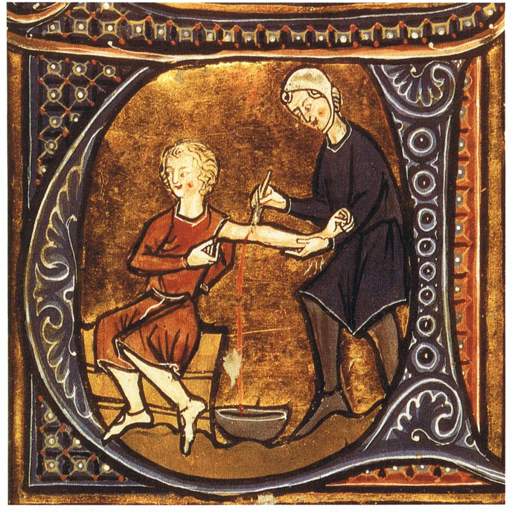 Bloodletting in Medieval Medicine